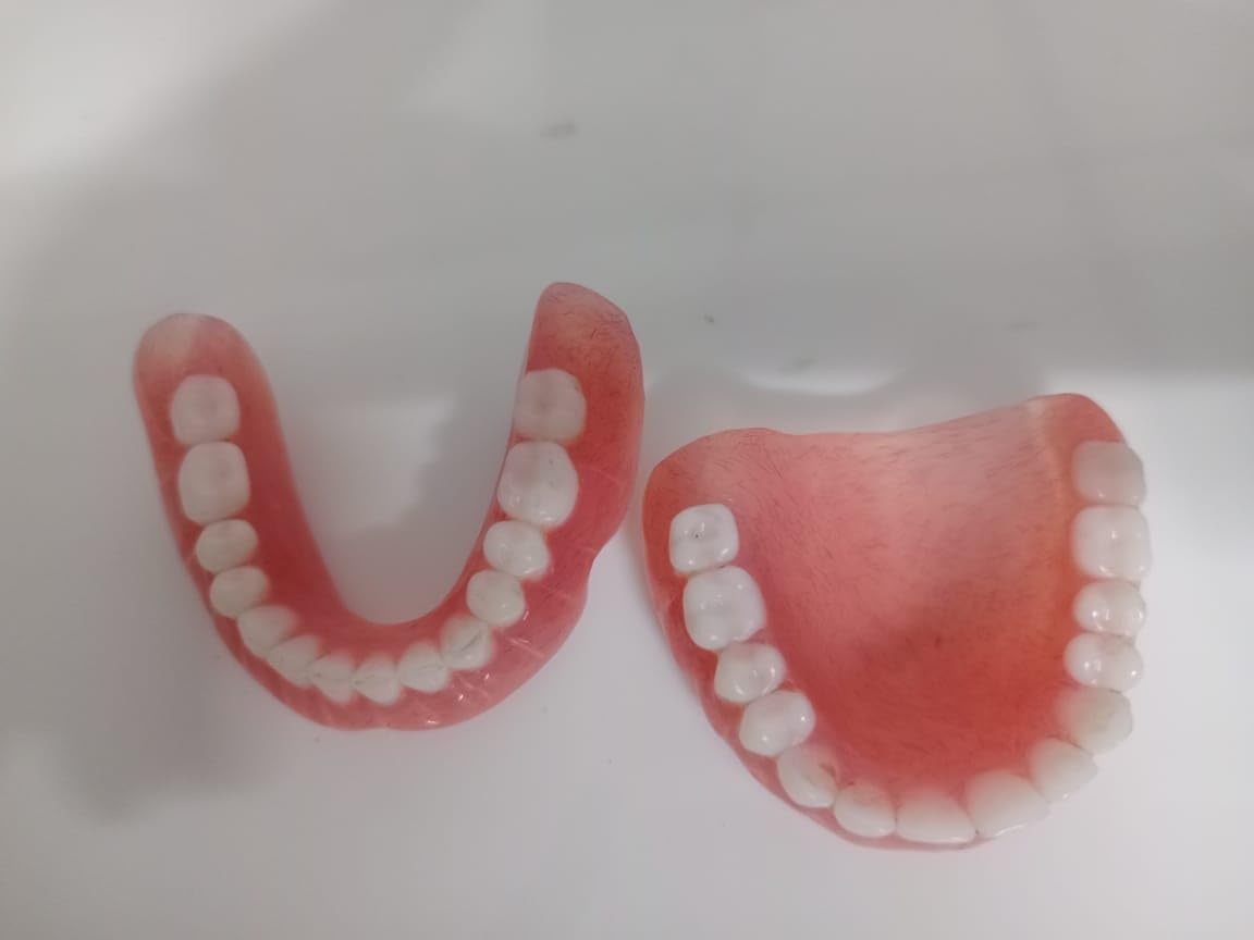 Denture full arch upper lower H56979