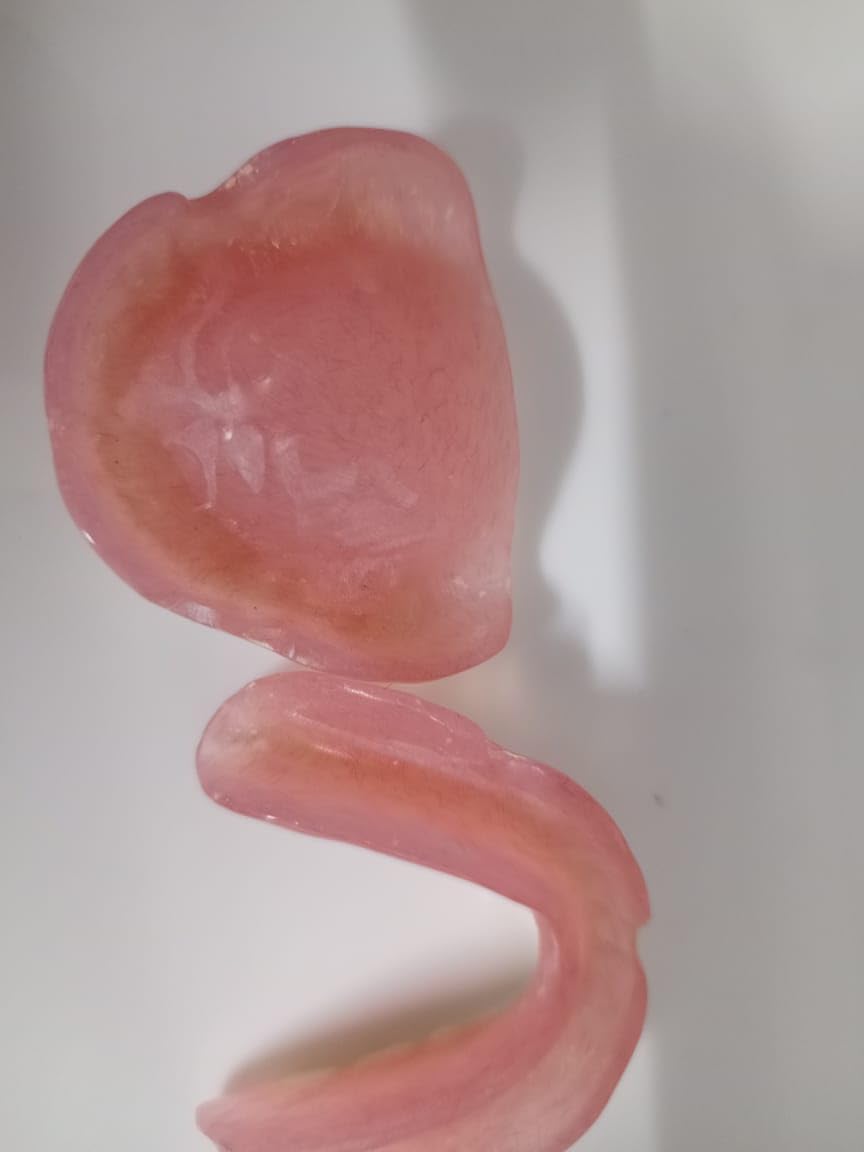 Denture full arch upper lower H56979