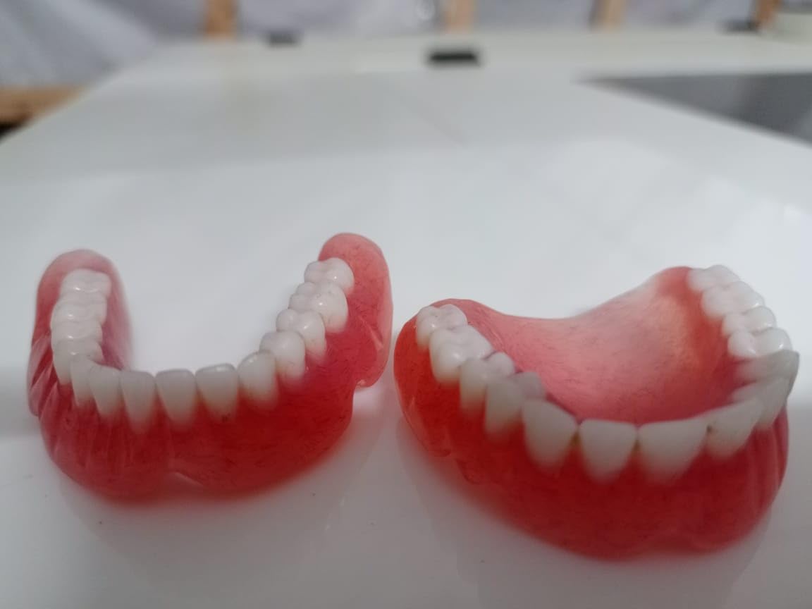 Denture full arch upper lower H56979